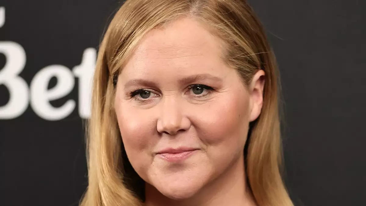 The True Beauty of Amy Schumer