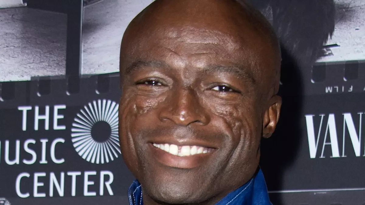 The Transformation of Seal: From Dreadlocks to a Bald Head