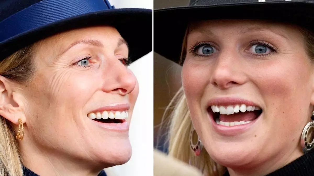 Decoding Zara Tindall’s Perfect Smile Transformation