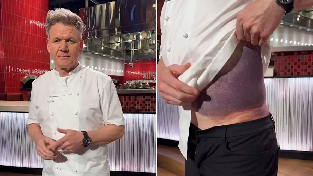 Gordon Ramsay’s Cycling Accident: A Reminder of the Importance of Safety