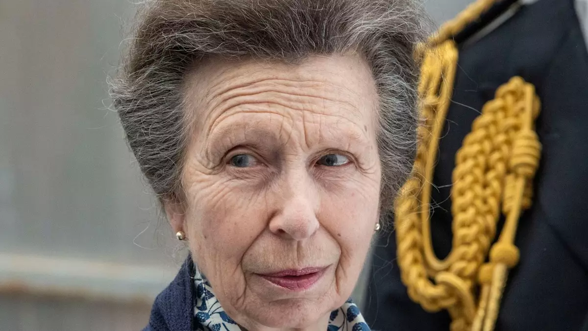 Princess Anne’s Injury: A Concerning Situation