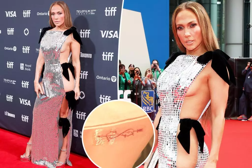 Celebrity Drama: Jennifer Lopez Removes Ben Affleck Tattoo Amid Divorce