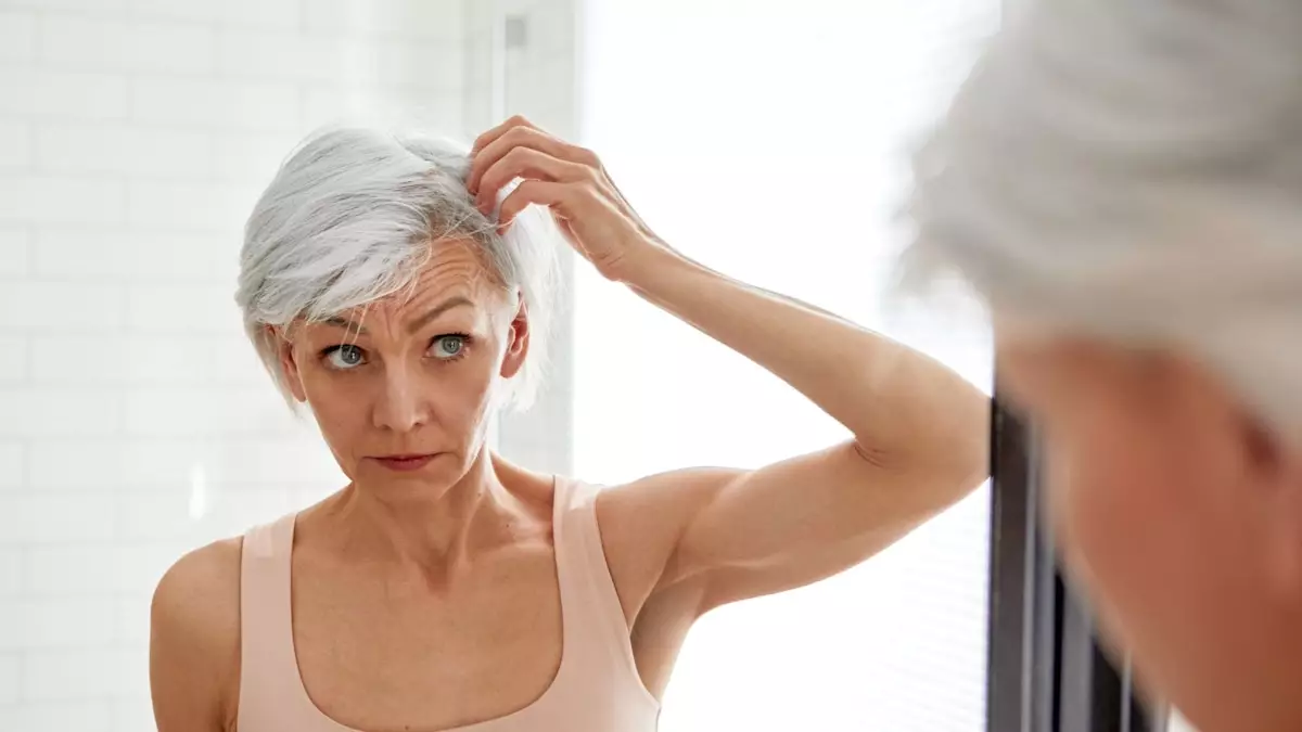 The Rising Trend of Hair Transplants Among Women: Understanding the Shift