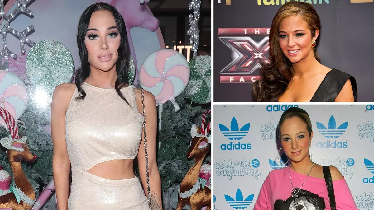 The Journey of Tulisa Contostavlos: A Candid Reflection on Beauty and Health