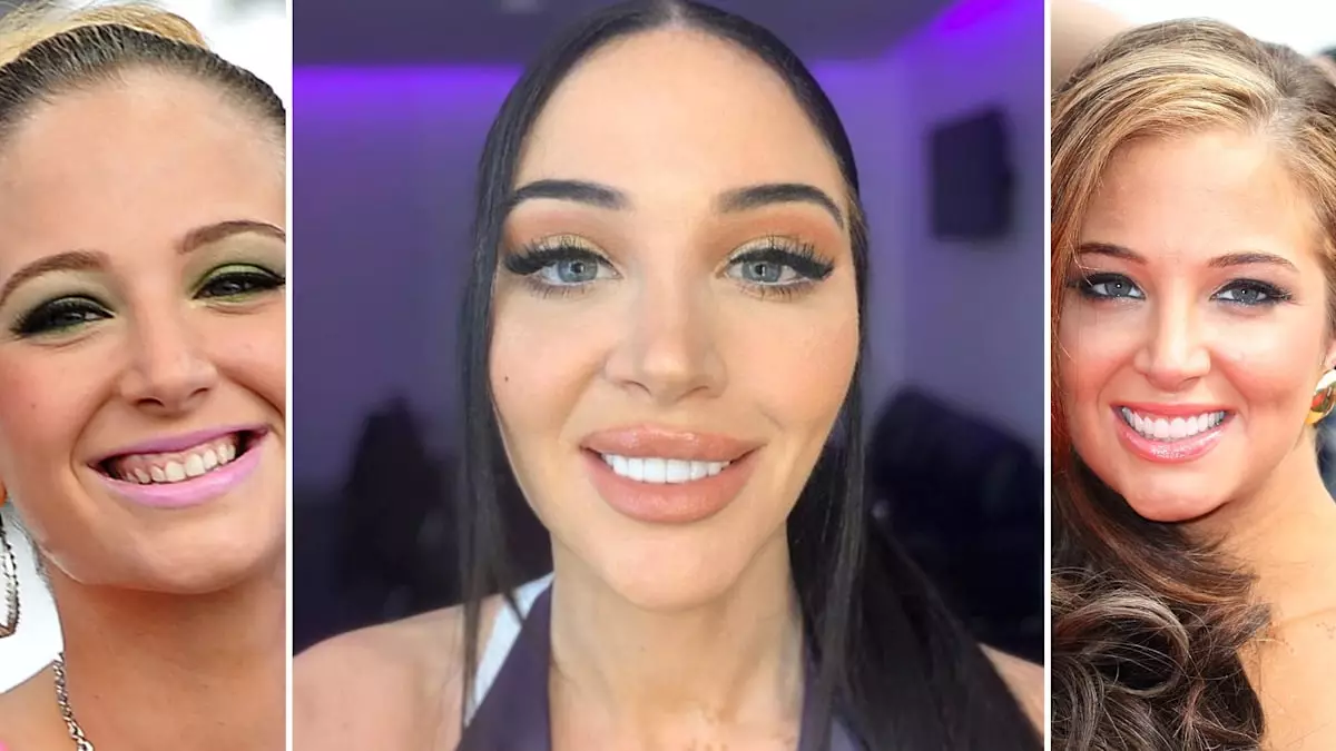 Tulisa Contostavlos: The Journey to a Confident Smile