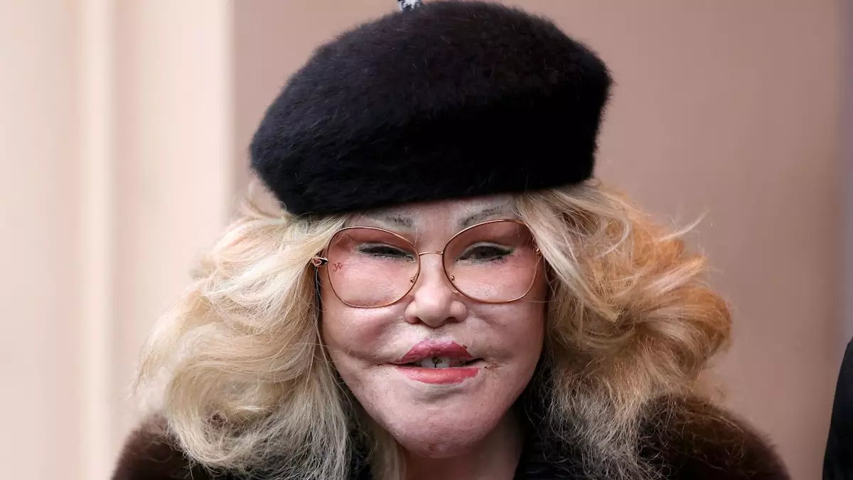 The Enigmatic Persona of Jocelyn Wildenstein: A Reflection on Beauty, Identity, and Fame