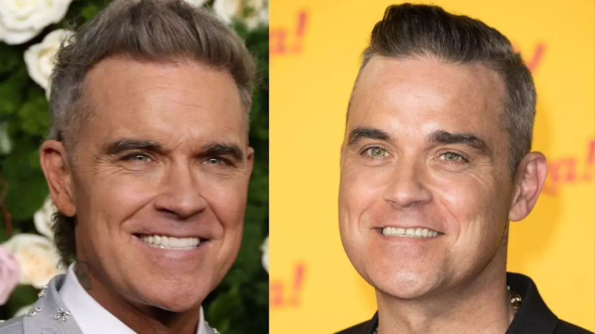 A New Smile, A Fresh Beginning: Robbie Williams’ Cosmetic Journey